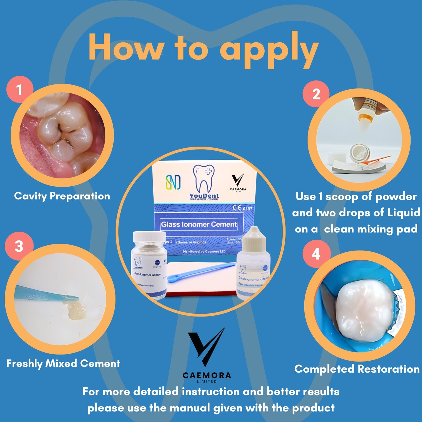 YouDent Glass Ionomer Dental Cement Type 1